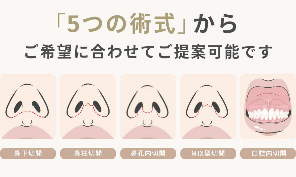 オータスクリニック｜人中短縮パターン