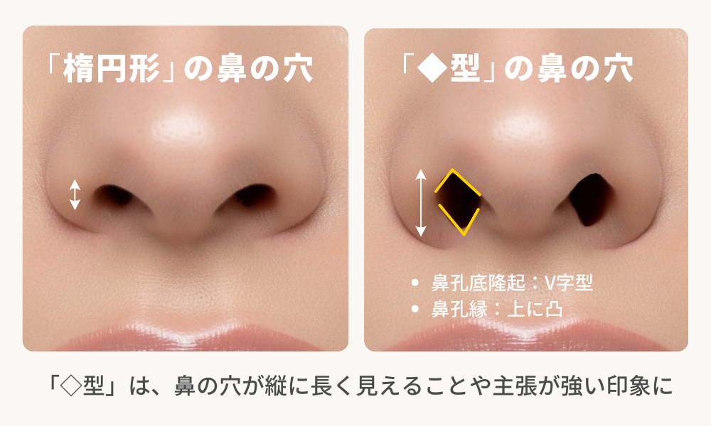 鼻孔底隆起（土手）と鼻の穴の見え方の関係性