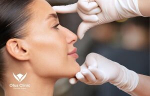 傷跡を目立たせない人中短縮｜鼻柱切開で自然に整えるオータスクリニック式デザイン