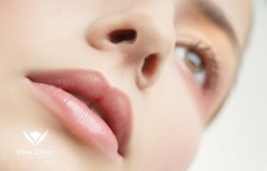 鼻柱切開人中短縮と鼻孔底隆起の関係｜鼻孔の形の変化と改善ポイントを詳しく解説！